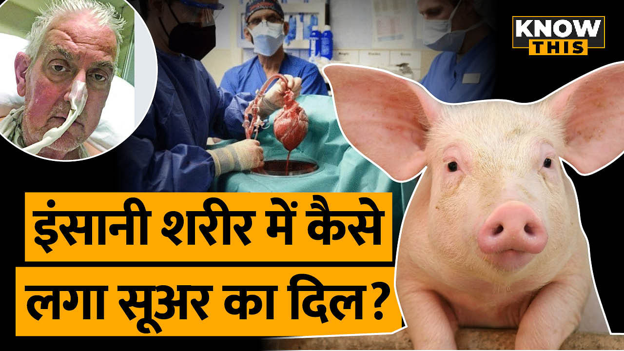 KNOW THIS: सूअर का दिल इंसान के शरीर में! जानें इस ट्रांसप्‍लांट के बारे में सब कुछ 