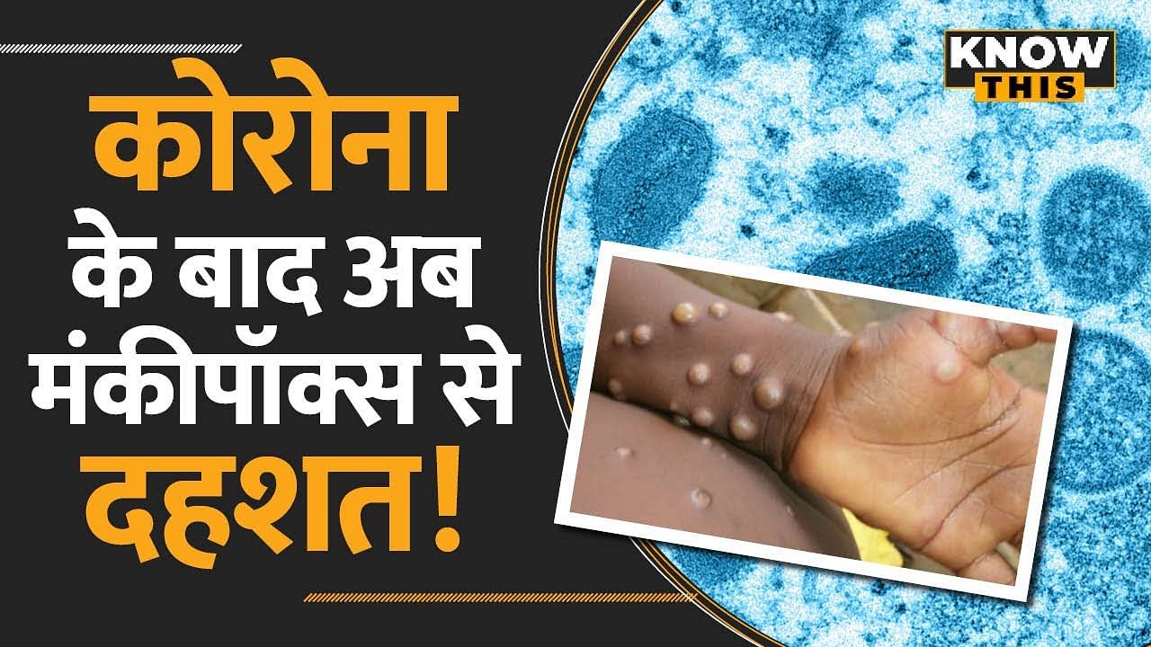 Coronavirus के बाद Monkeypox से दहशत, जानिए क्यों है खतरनाक और क्या लक्षण हैं? KNOW THIS | Monkeypox